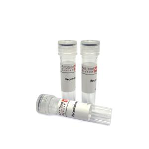 PNGase F(工具酶)YXX04901 产品图片